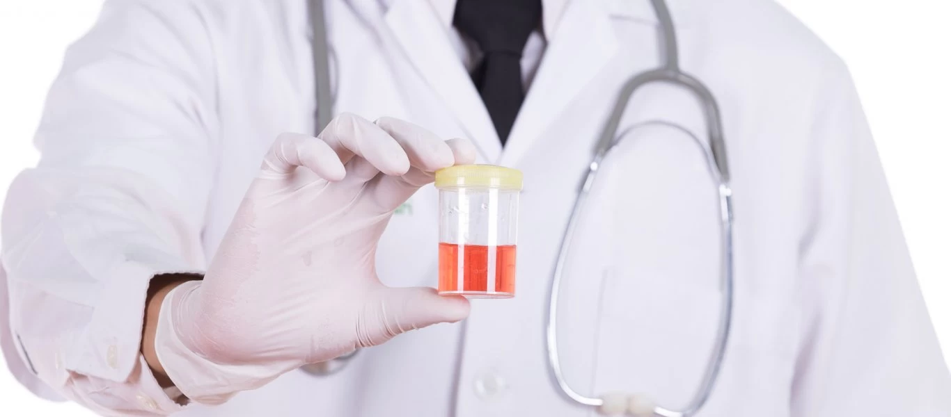 Αίμα στα ούρα: Αυτές είναι οι 7 πιθανές αιτίες